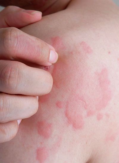 the Relationship Between High Stress and the Immune System