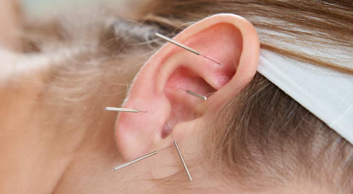 Soliman Auricular Allergy Treatments NYC by Marc Bystock L.Ac.