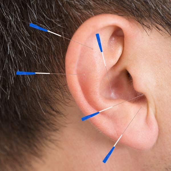 Ear with acupuncture needles inserted. Gray hair visible. Needles have blue handles.