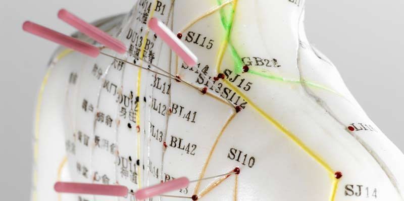 The Science of Acupuncture: Unveiling Its Benefits for Health and Healing