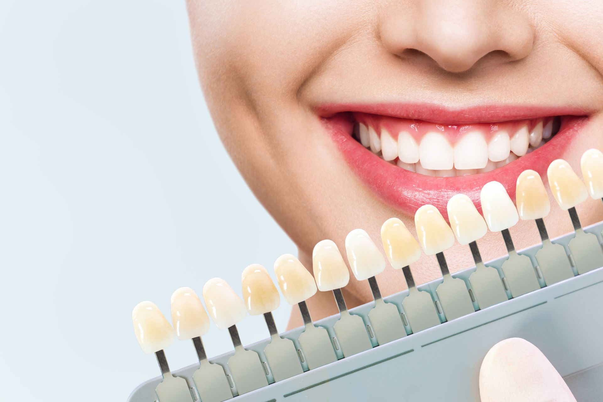 Woman smiling brightly, highlighting dental implants and cosmetic whitening.