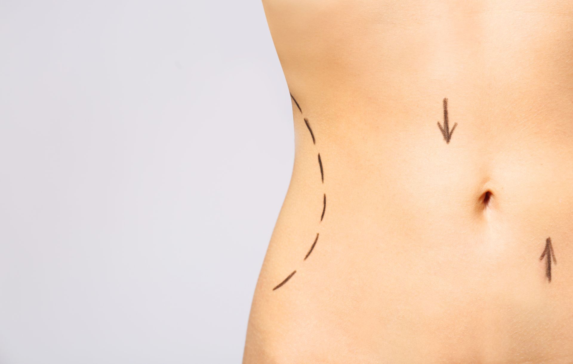 Person receiving body contouring treatment with device on abdomen, in a spa setting.