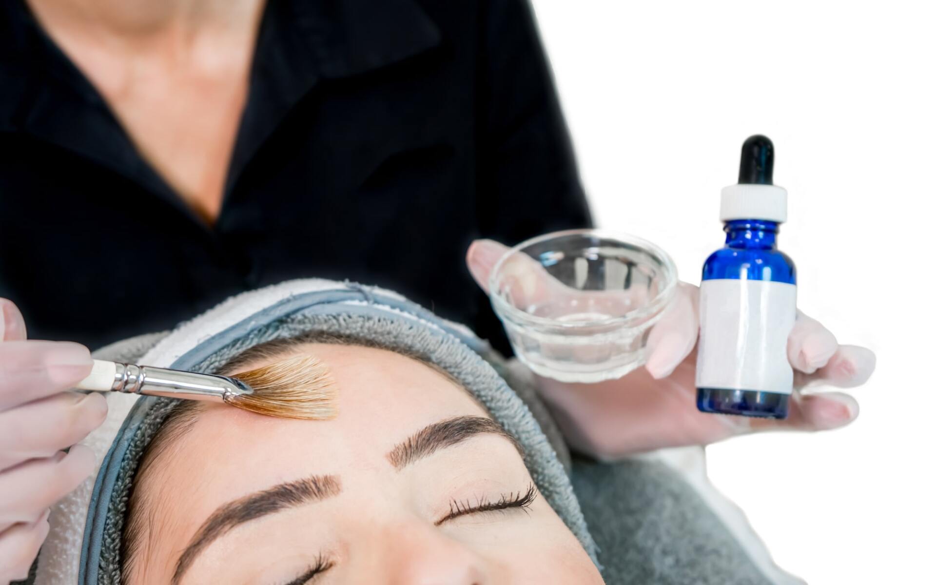 chemical peels vs. facials