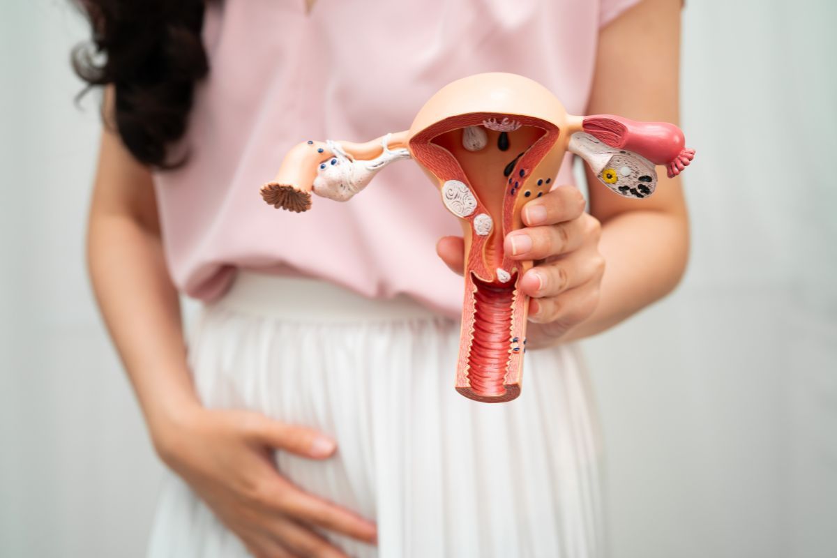 Malformações uterinas: conheça os principais tipos