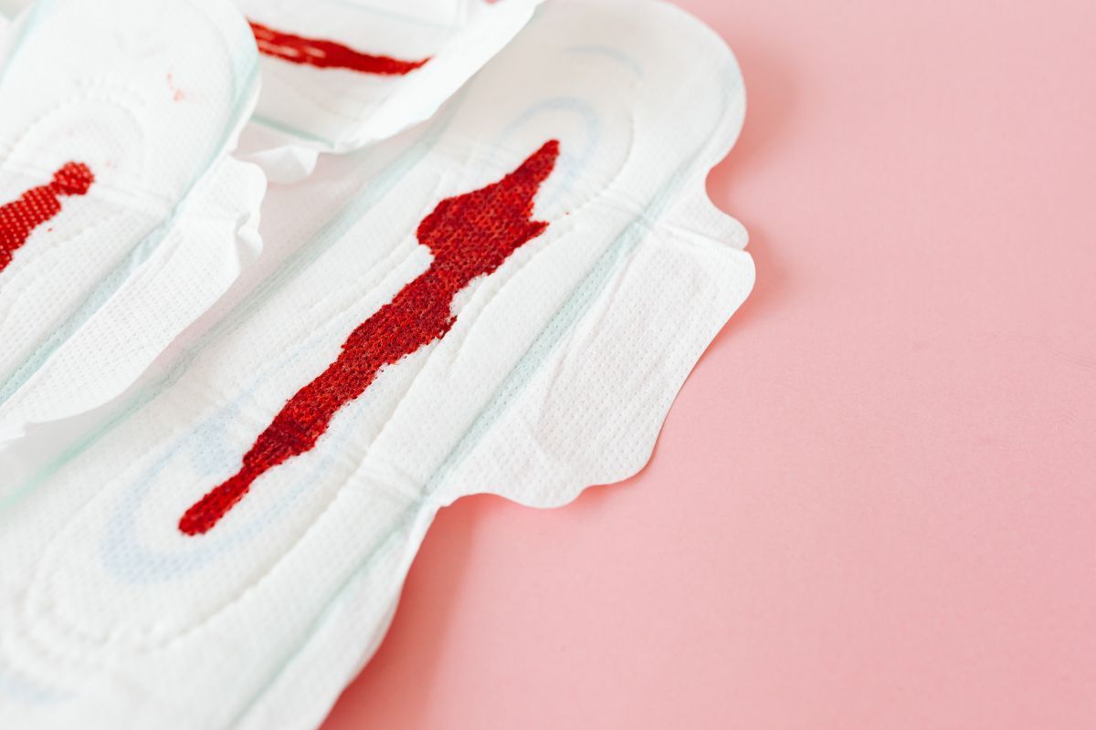 Pólipo endometrial: quando a cirurgia é necessária?