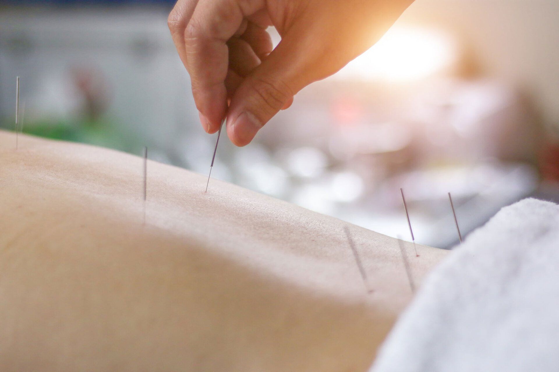 Traditional Chinese Medicine Treatment — Plympton, SA — Aaron Slape Acupuncturist