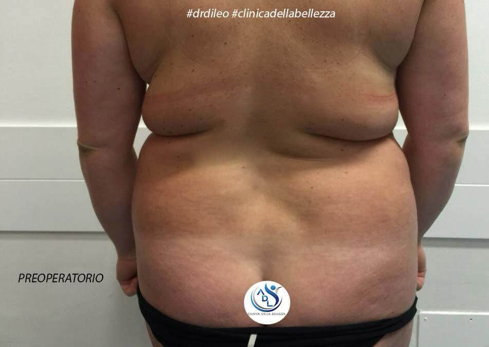 In una foto è mostrata la parte posteriore del busto di una donna.