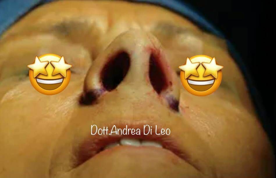 Un primo piano del volto di una persona con faccine sorridenti sugli occhi.