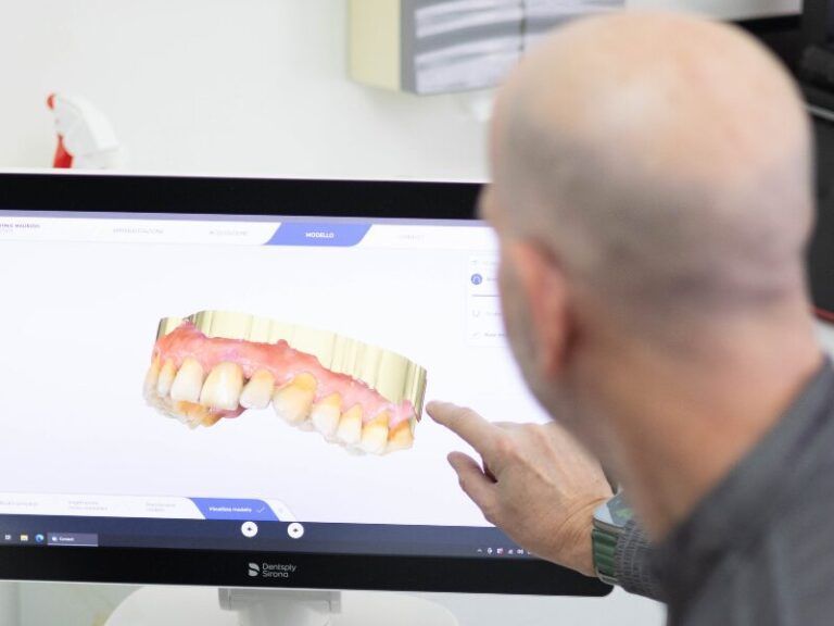 Una persona indica un modello dentale sullo schermo di un computer in un ufficio luminoso.