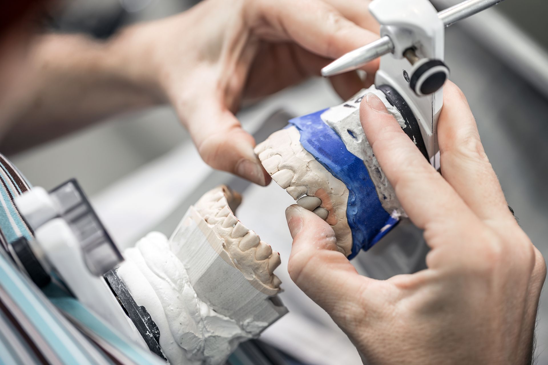 Dental technician working on smile restore.