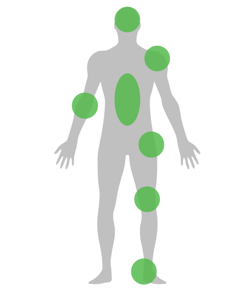 Gray human silhouette with green markers on the head, shoulder, torso, arm, knee, and foot
