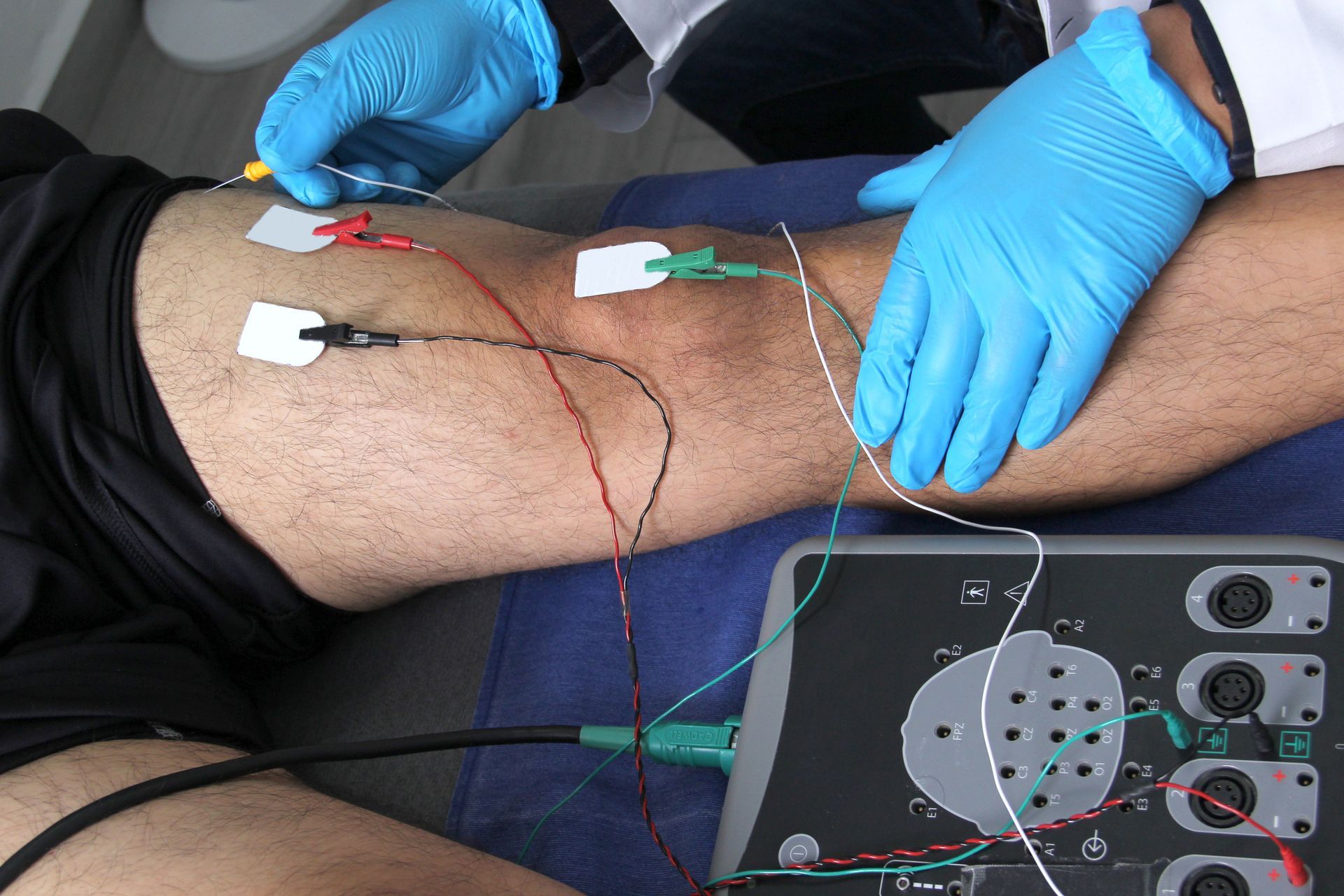 A person is getting electrodes on their leg.