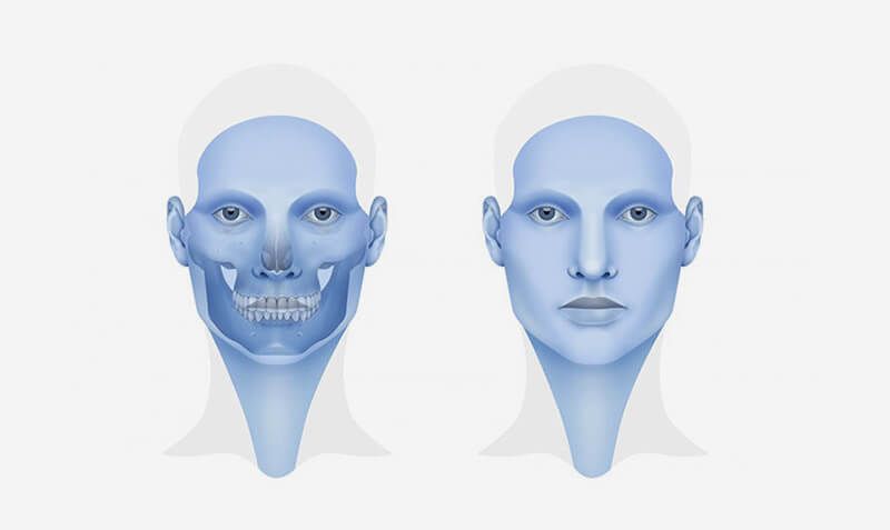 DR. CARLOS SÁNCHEZ GUTIÉRREZ - ATENCIÓN A FRACTURAS FACIALES