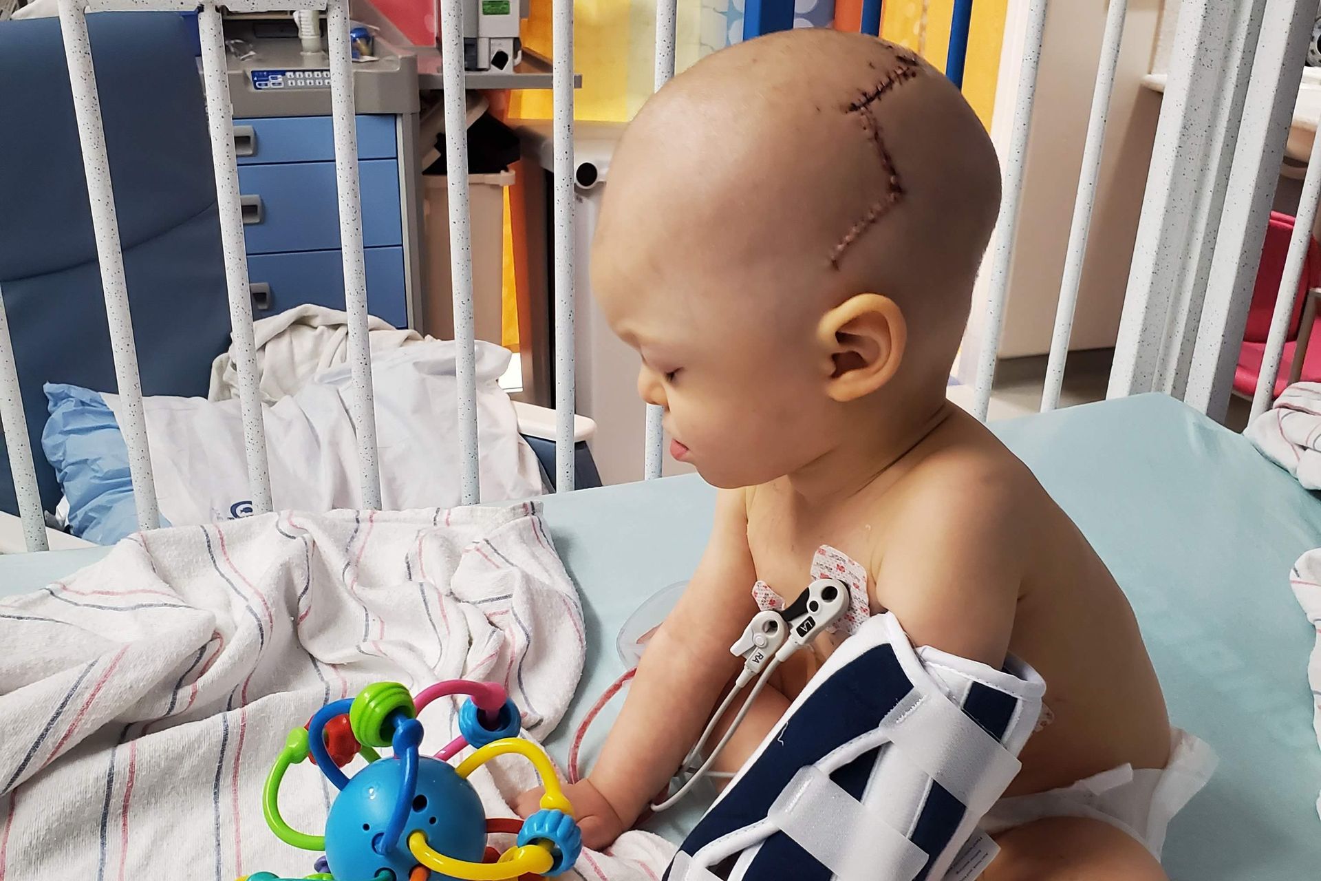 A baby with a stitched head is sitting in a hospital bed playing with a toy.