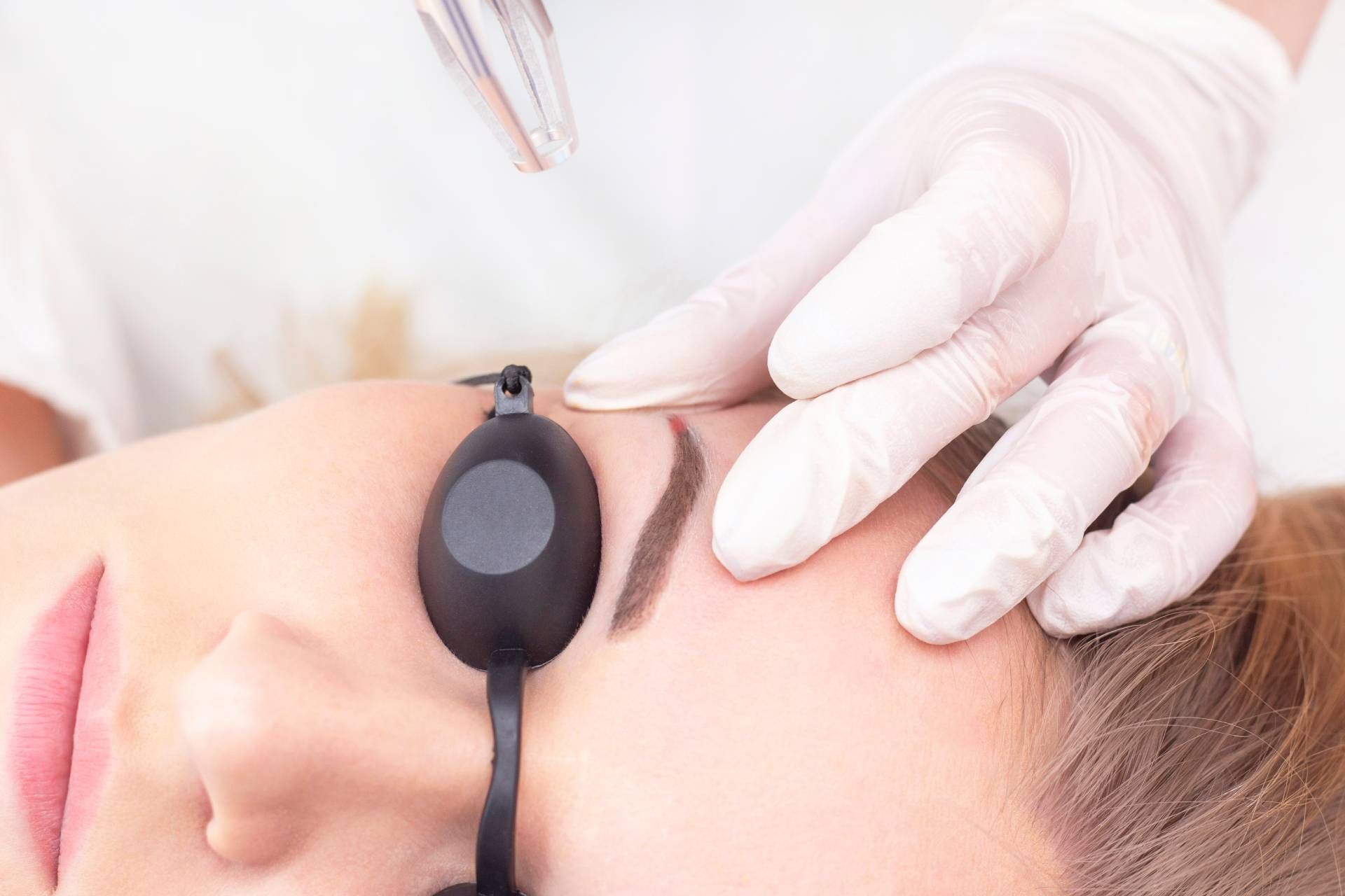 Young woman undergoes laser microblading removal near Lexington, KY