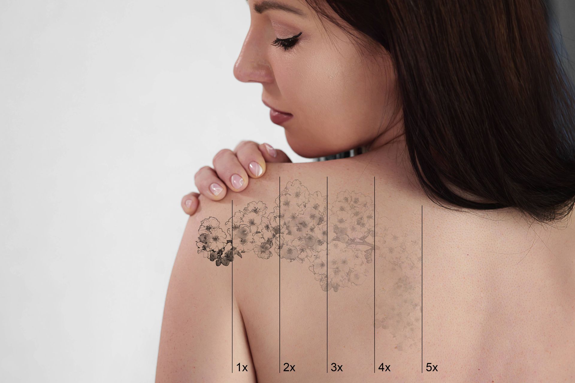 Concept of someone receiving laser tattoo removal treatments at Lexington Tattoo Removal near Lexington, KY