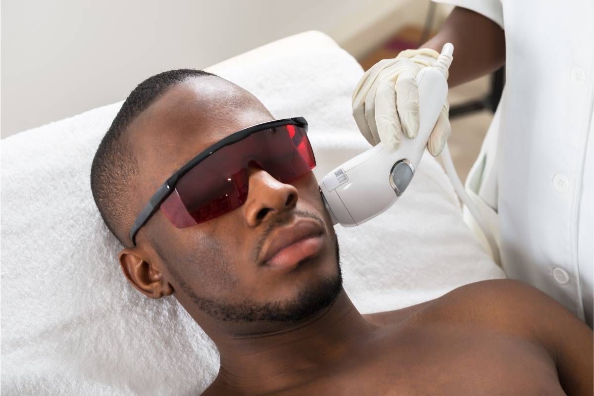 A man receiving laser hair removal on his face near Lexington, Kentucky (KY)