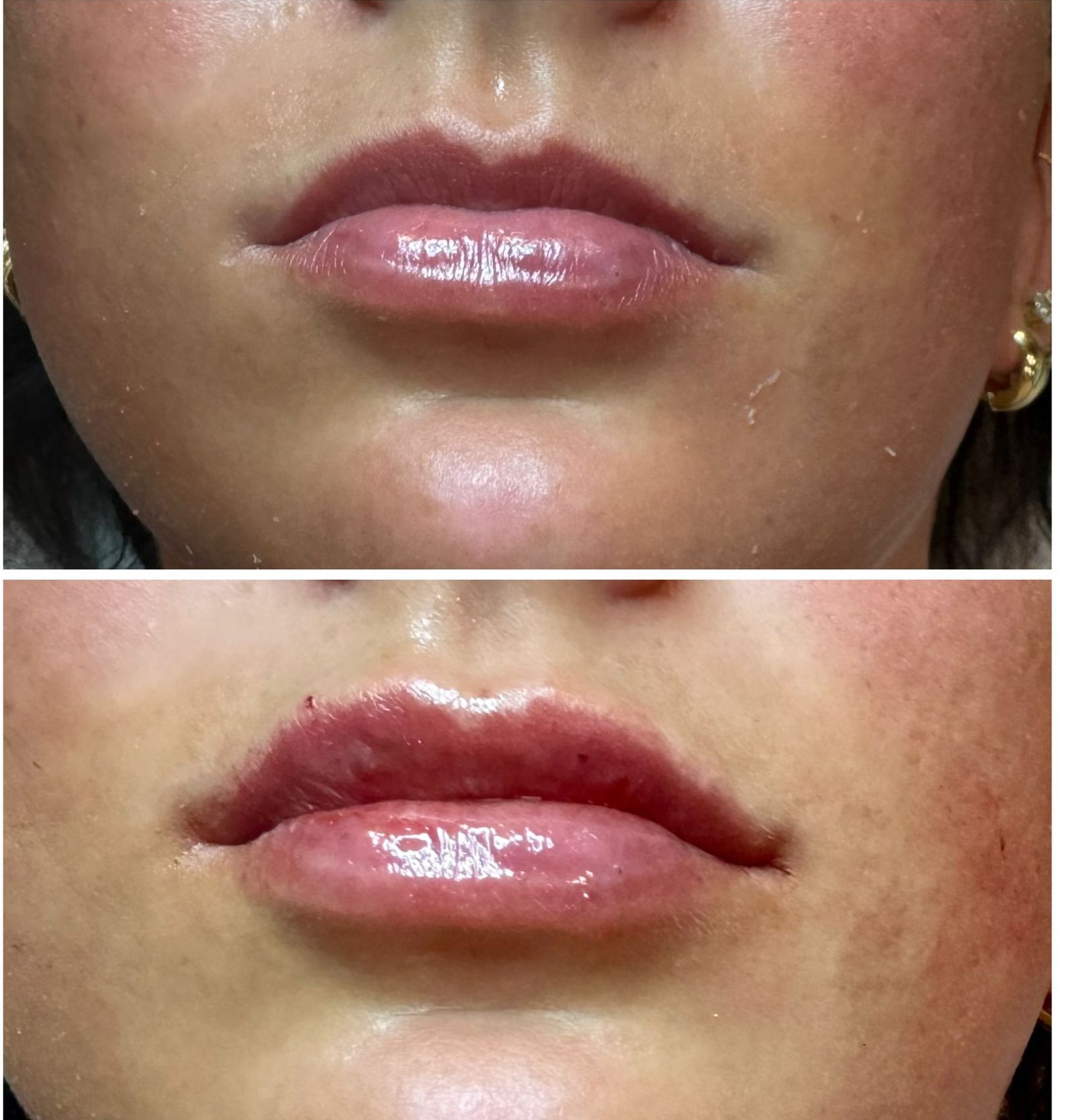 A before and after picture of a woman 's lips with earrings