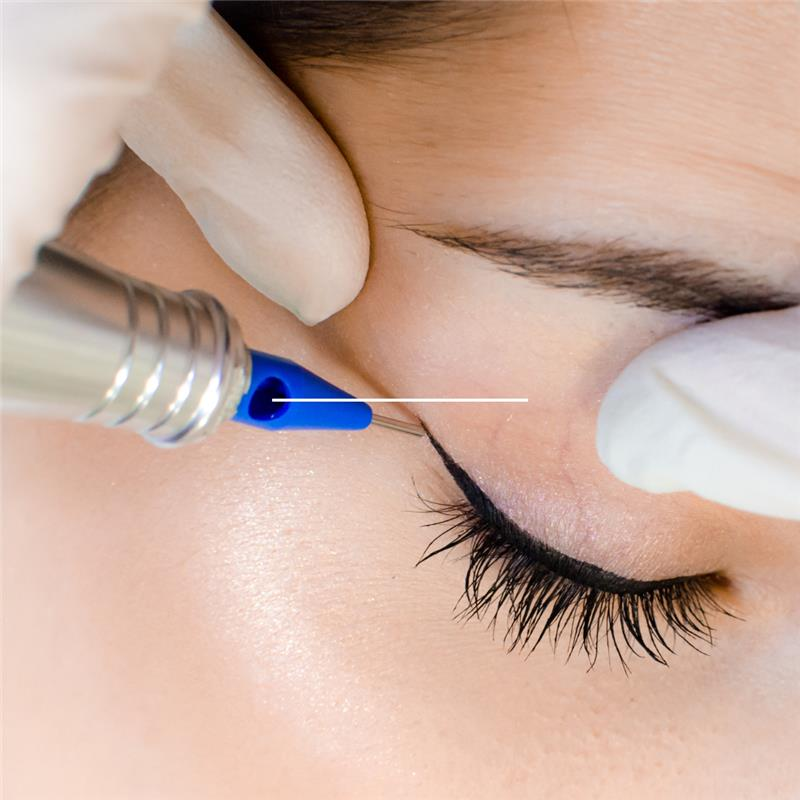 Permanent Eyeliner Being Applied to an Eye — Aqua Marine Skin and Beauty in Tuncurry, NSW