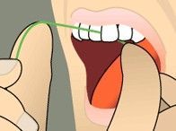 Dental floss being pulled between upper teeth and gums inside an open mouth.