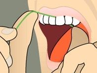 Person opening mouth while flossing between front teeth with green floss.