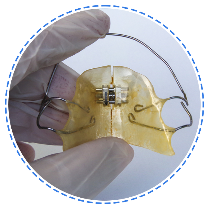 Orthodontic Appliance for Dental Correction — Launceston, TAS — Everything Dental Pty Ltd Orthodontic Appliance for Dental Correction — Launceston, TAS — Everything Dental Pty Ltd