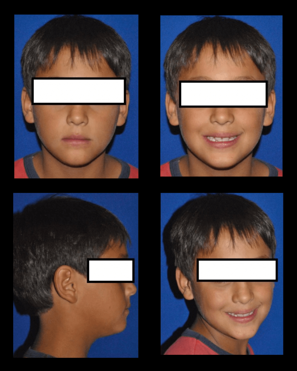 FOTOGRAFÍAS EXTRAORALES