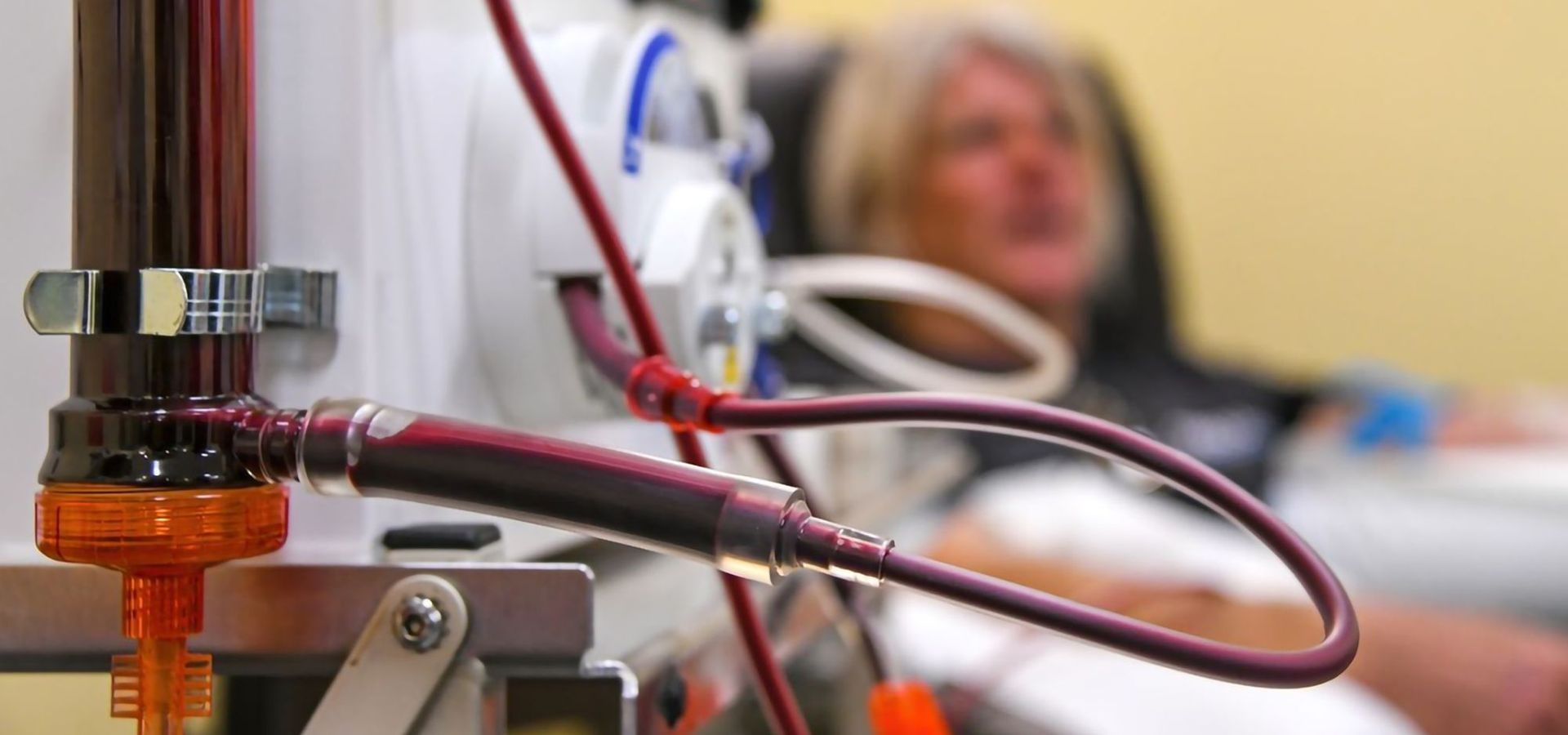 IV tubing and medical equipment in foreground, with a blurred patient lying in a hospital bed behind it