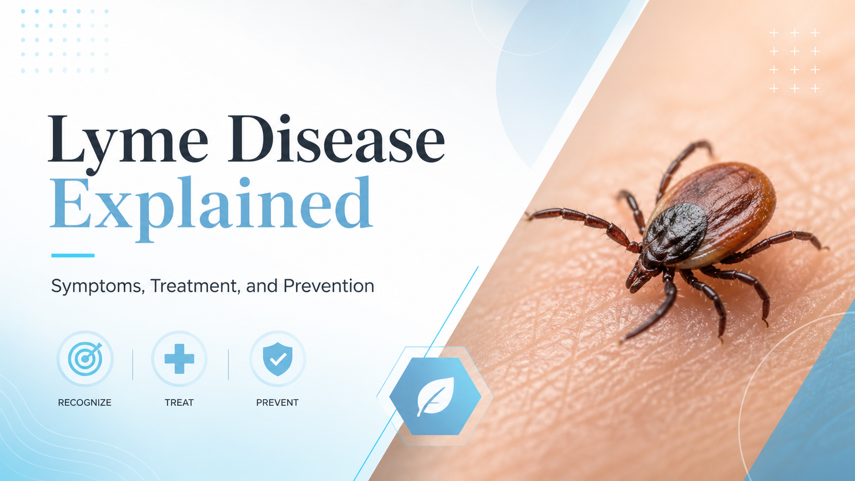 Lyme Disease Explained poster with a tick on skin and blue medical icons, promoting symptoms, treatment, and prevention
