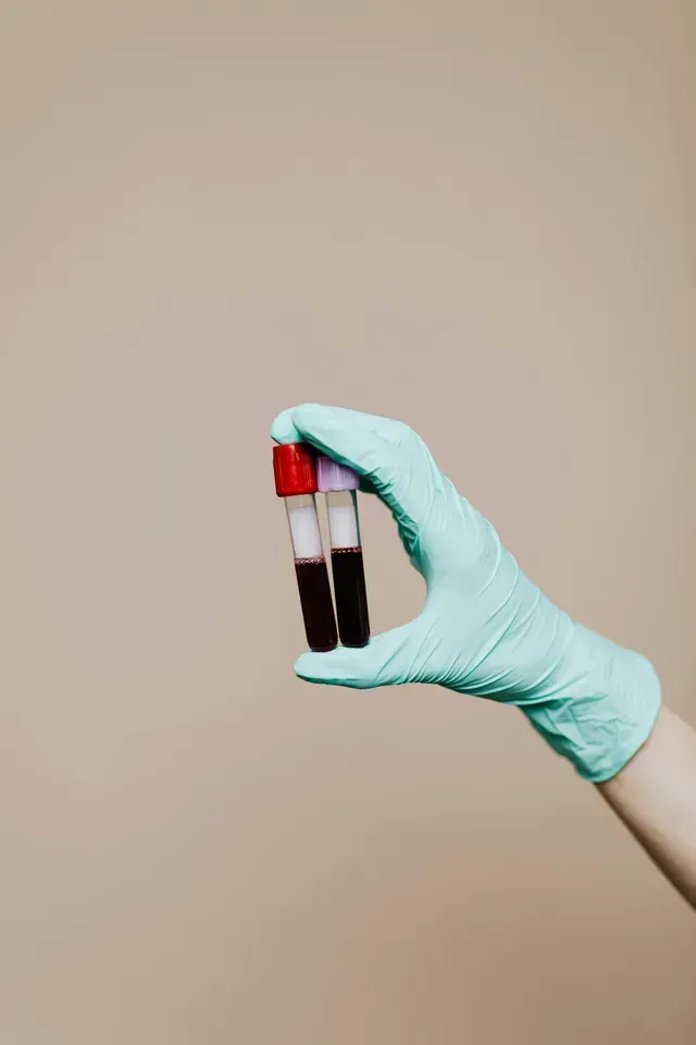 Gloved hand holding two blood-filled test tubes against a plain beige background