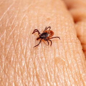 A small tick crawling on human skin, shown in close-up.