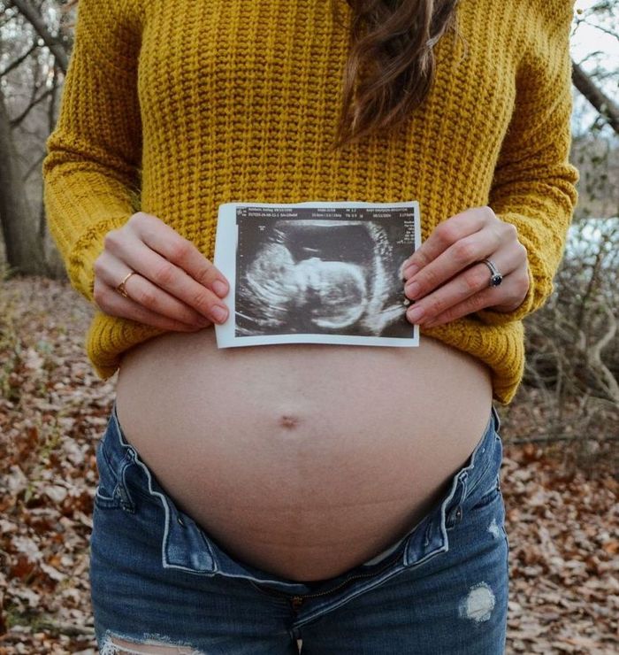 Pregnancy doula 
