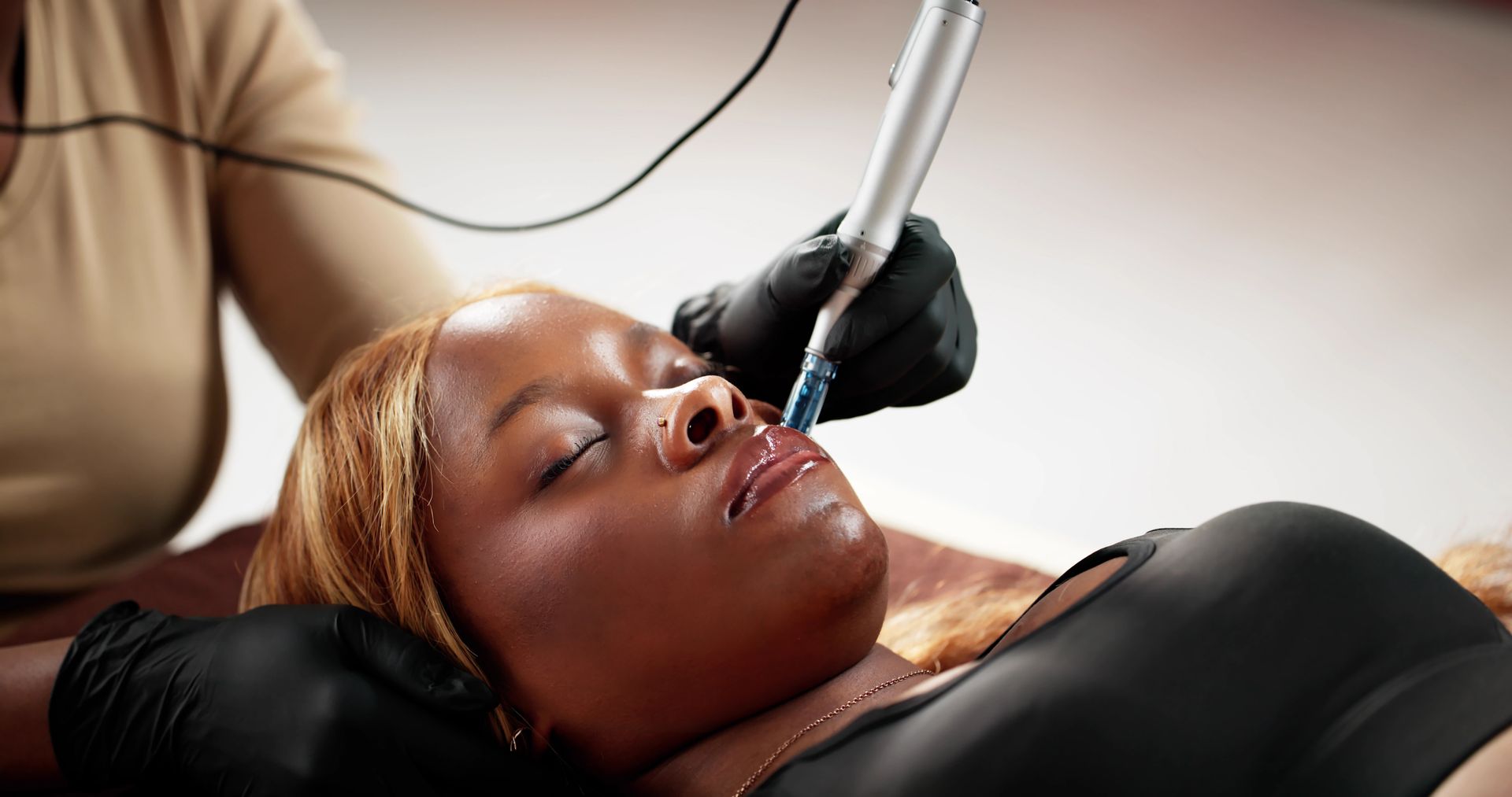 A practitioner in white gloves uses a microneedling device on a person's forehead during a professional skin treatment.