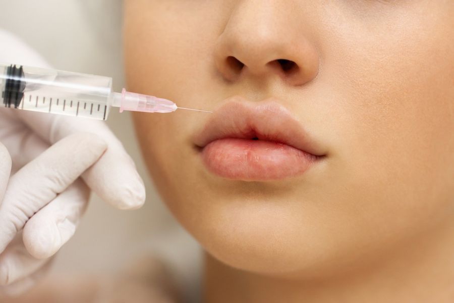 A gloved hand holds a syringe, performing a cosmetic injection into the upper lip of a person.