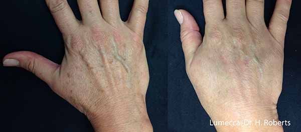 A close up of a person 's hands on a black background.