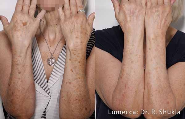 A before and after photo of a woman 's hands