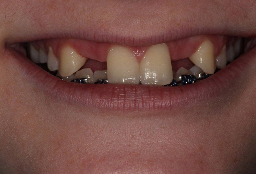 restorative-dentistry