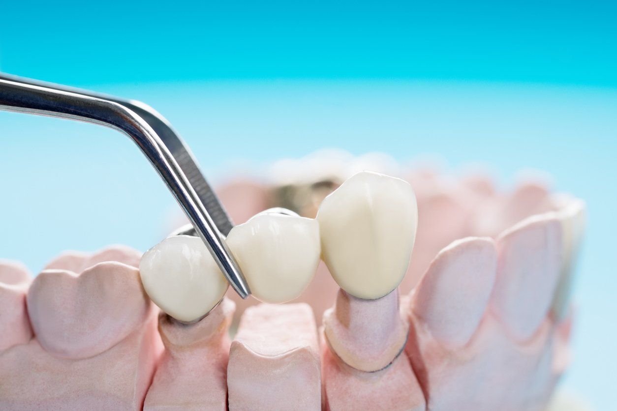 Restorative Dentistry