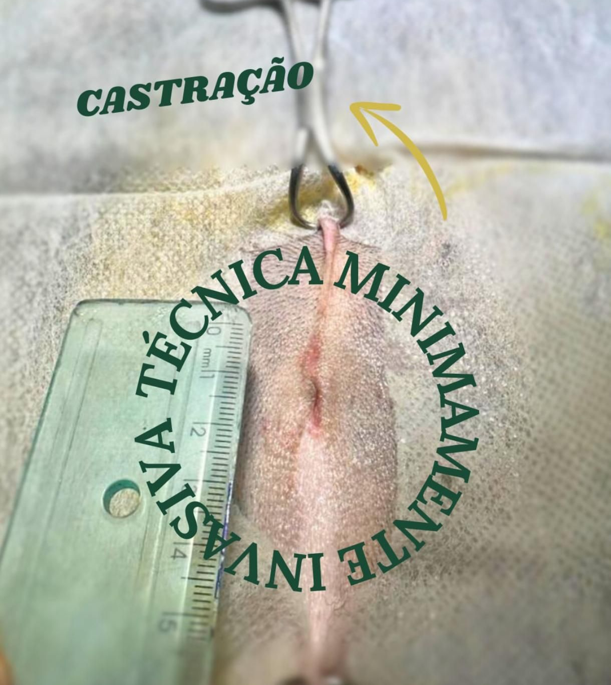 Imagem de uma cirurgia utilizando a técnica minimamente invasiva.