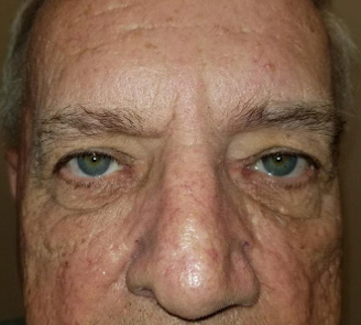 A close up of a man 's face with blue eyes.