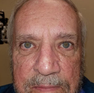 A close up of a man 's face with a beard and blue eyes.