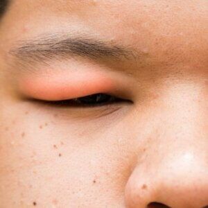 A close up of a person 's eye with a red eye.
