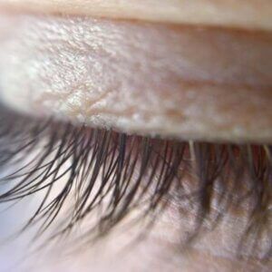 how long does a stye last
