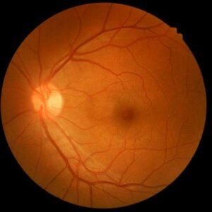 retina specialist near me