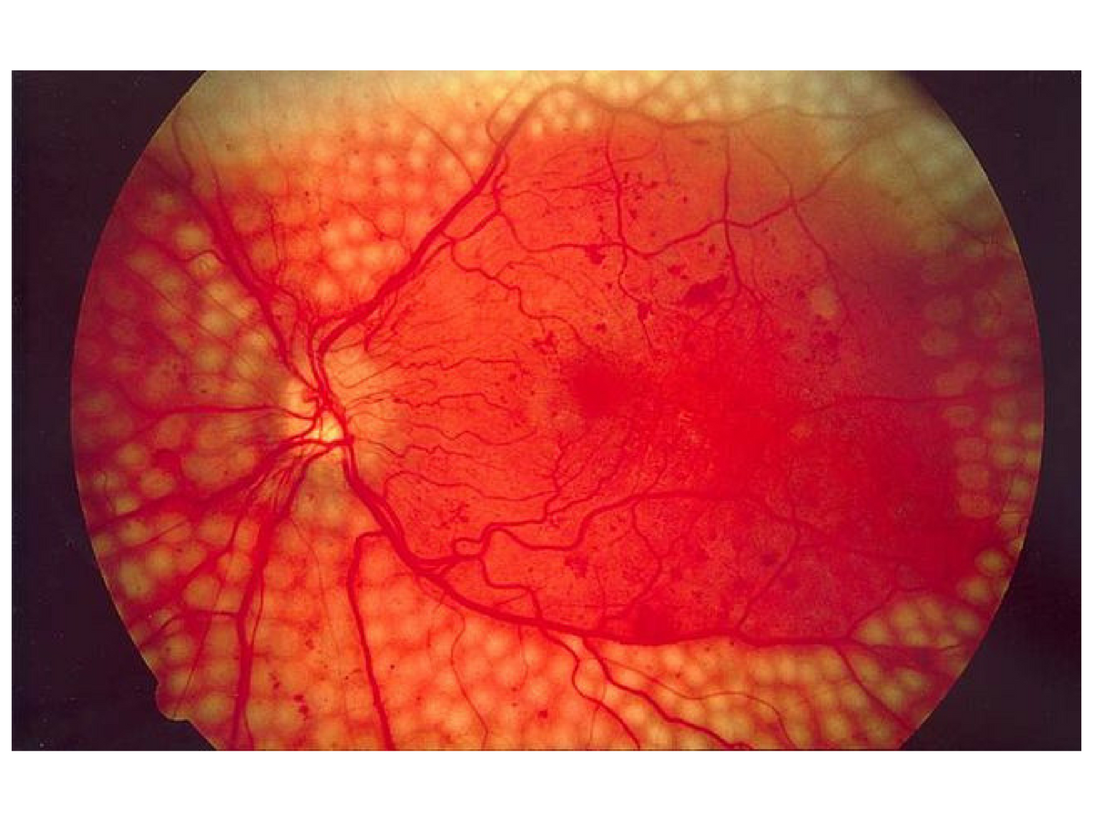 A close up of a person 's eye with a red circle in the middle.