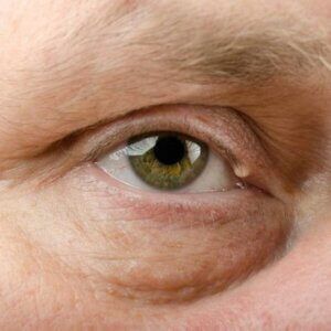 Oculoplastic surgeon Knoxville, TN