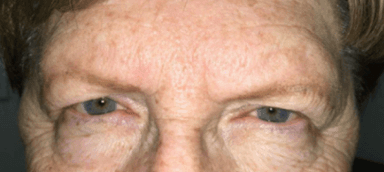 A close up of a man 's face with blue eyes.