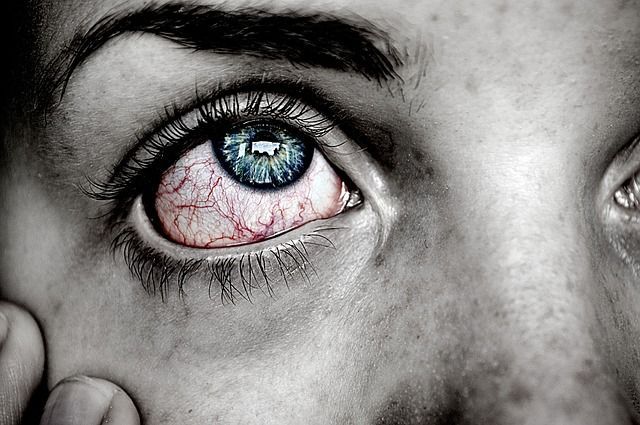 A close up of a person 's eye with a red eye.