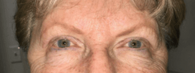 A close up of an older woman 's face with blue eyes.