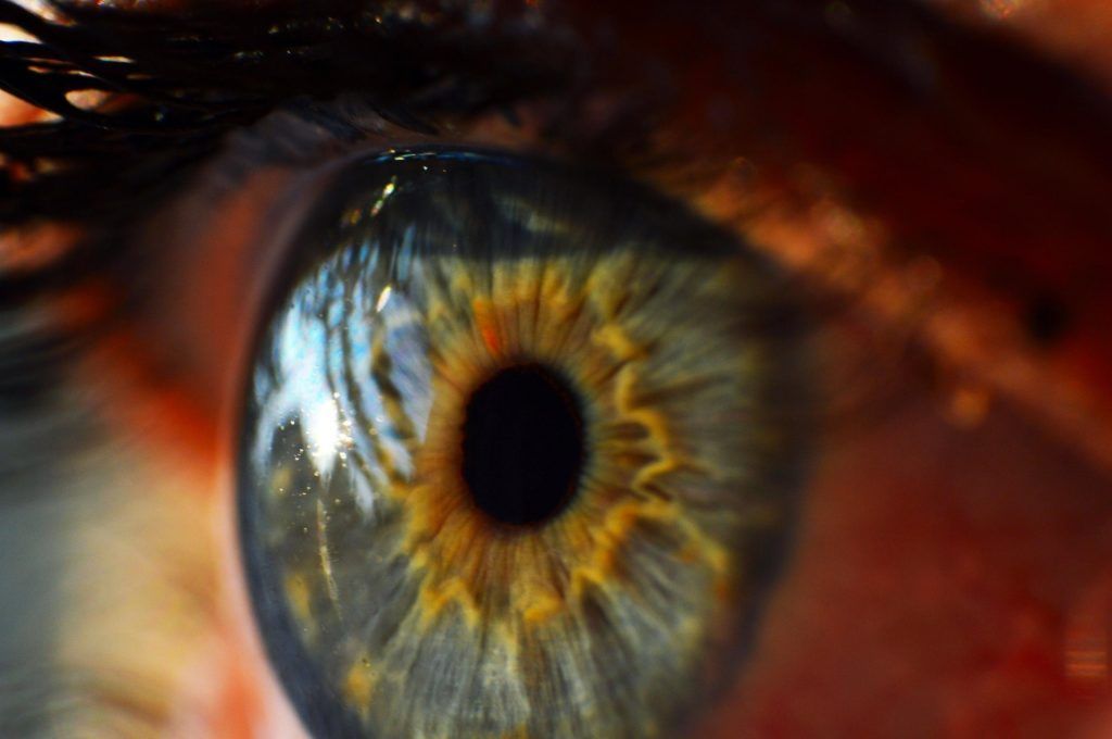 A close up of a person 's blue eye with a yellow iris